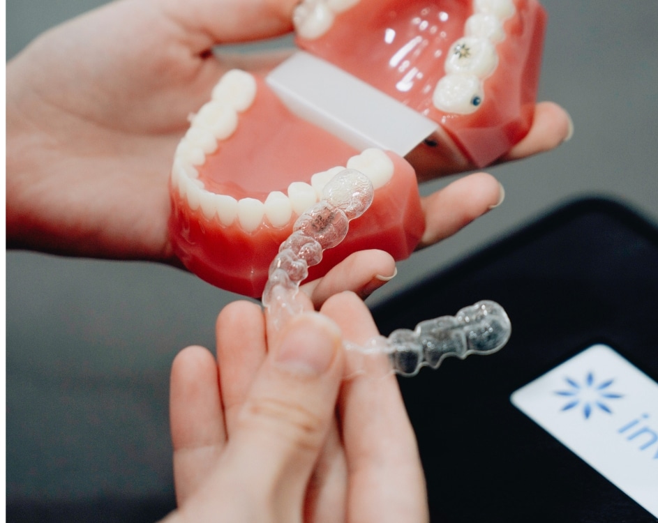 How Much Does Invisalign Cost in Melbourne?